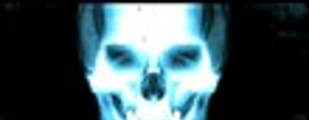 Ролик Dead Space 2