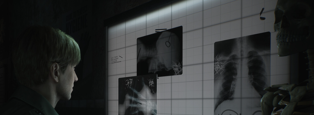 В ремейке Silent Hill 2 медсёстры не такие сексуальные? Знакомимся с польским видением культовых персон