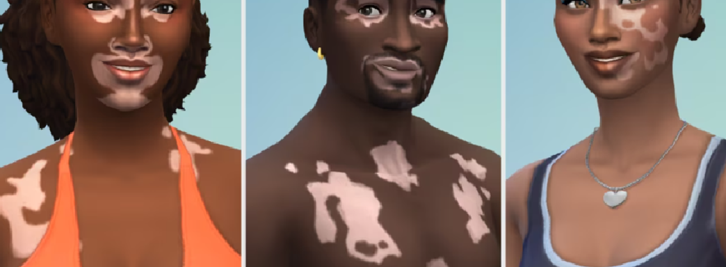 В The Sims 4 добавили витилиго для симов. Новый уровень репрезентации в игре Maxis