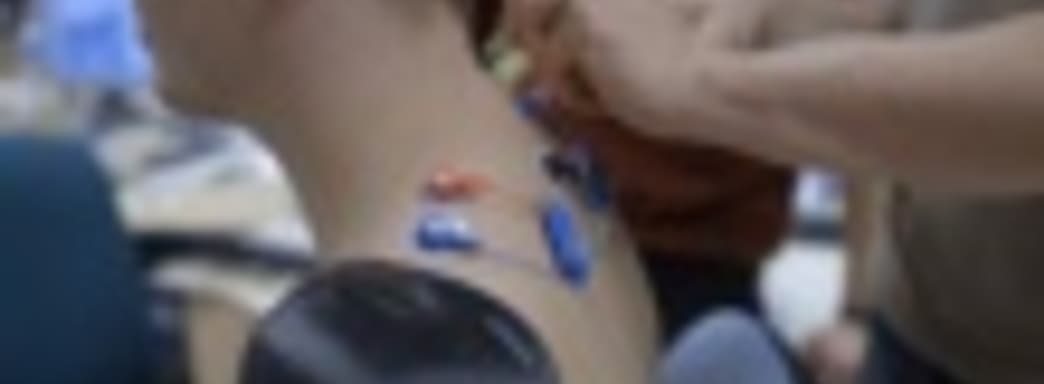 Konami помогает в создании протезов для фаната Metal Gear Solid V: The Phantom Pain