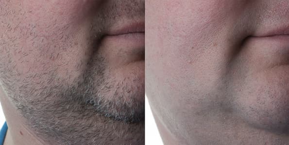 Электробритва Philips S9151