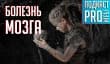 [5.30] Подкаст PRO игры: болезнь мозга