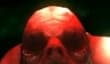 Dementium 2 HD — зачем?!