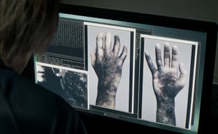 Resident Evil Requiem демонстрирует PSSR 2.0 на PS5 Pro? Игра с новым уровнем качества