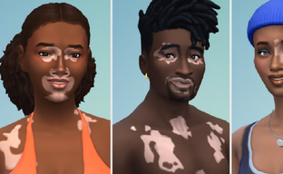 В The Sims 4 добавили витилиго для симов. Новый уровень репрезентации в игре Maxis