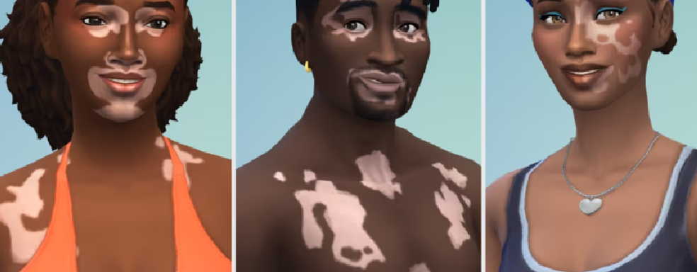 В The Sims 4 добавили витилиго для симов. Новый уровень репрезентации в игре Maxis
