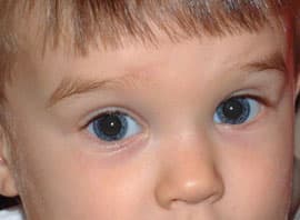 Удаление эффекта красных глаз