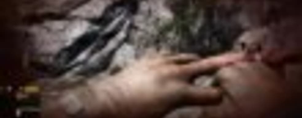 Far Cry 4 - анимации исцеления