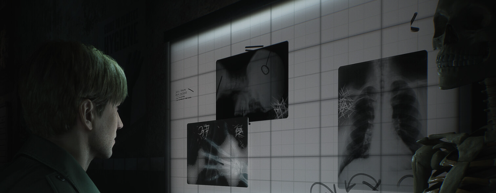 В ремейке Silent Hill 2 медсёстры не такие сексуальные? Знакомимся с польским видением культовых персон