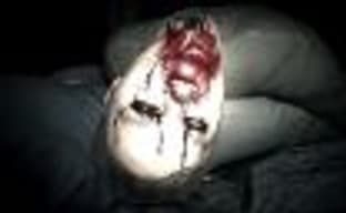 Целебные травы и сражение с бессмертным врагом в новых роликах Resident Evil 7