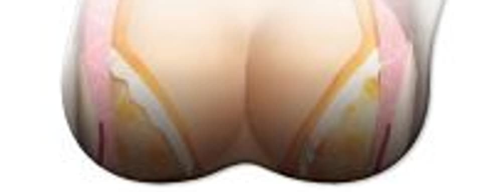 Коврики для мыши с изображением героинь Dead or Alive Xtreme: Venus Vacation обеспечивают комфорт вашим запястьям