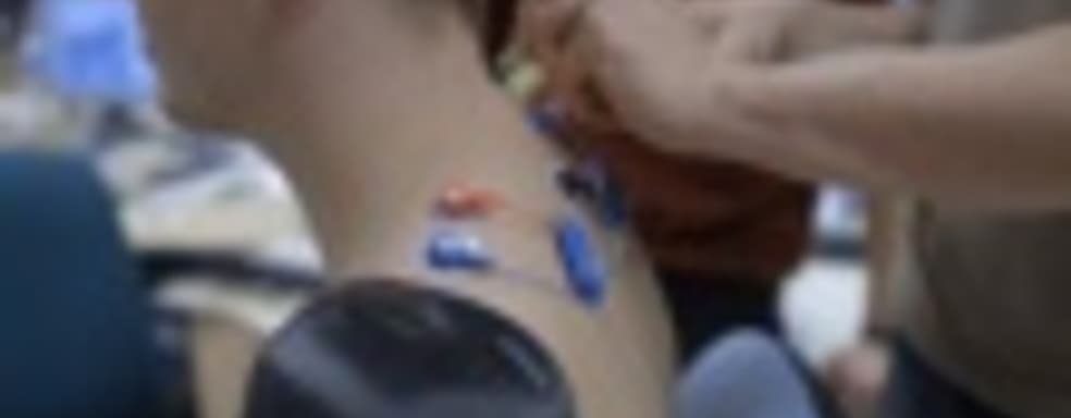 Konami помогает в создании протезов для фаната Metal Gear Solid V: The Phantom Pain