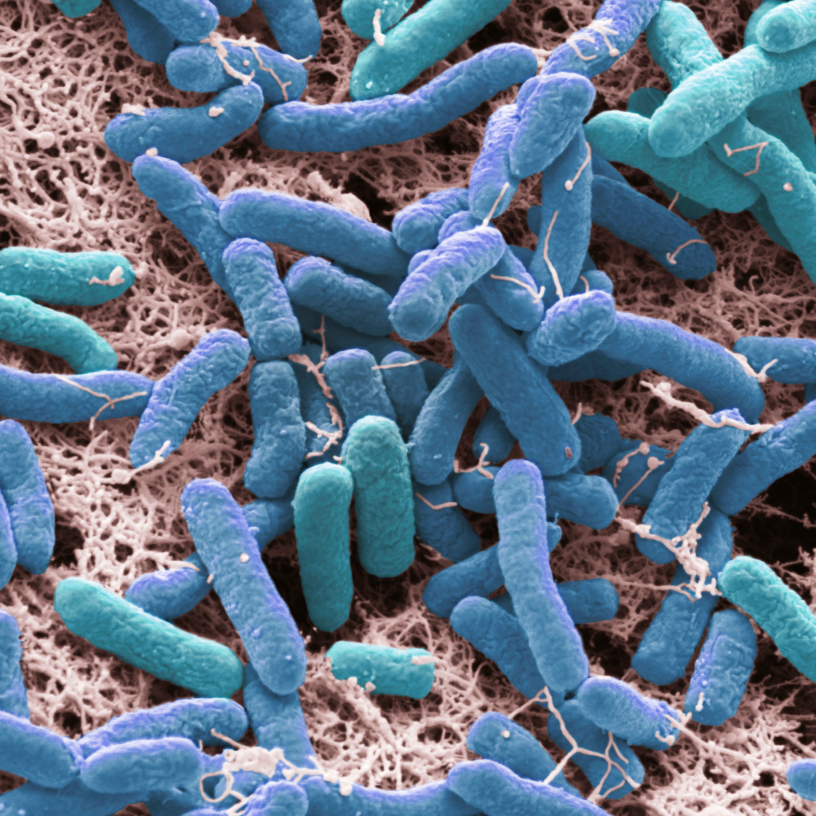 Pseudomonas aeruginosa