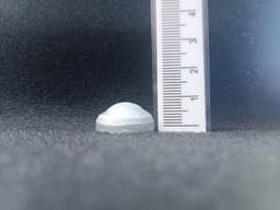 Российские учёные создали керамический щиток для защиты глаз пациента при лучевой терапии