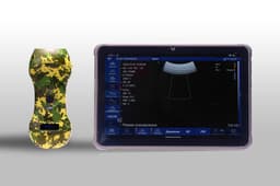 «Калашников» отправит на фронт новейшие портативные аппараты УЗИ для военных 