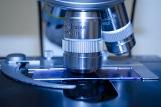 Breakthrough in Oncology: New Russian Melanoma Vaccine Shows 90% Efficacy