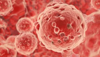 Científicos de ITMO encuentran una forma de "reeducar" el cáncer con láser: un método para reprogramar la inmunidad dentro del tumor