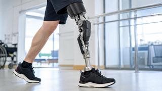 La prótesis se adaptará a cada paso: "Metiz" lanzó un módulo de rodilla "inteligente"