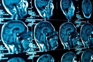 En Skoltech han desarrollado nanogotas para un diagnóstico preciso mediante resonancia magnética y ultrasonido
