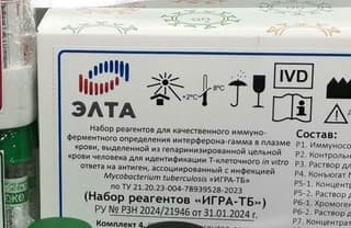 Instead of the Mantoux test: production of a Russian tuberculosis test launched in the Moscow region