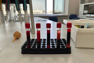 Scientists from Stavropol have created an innovative composition for blood preservation