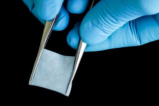 La Universidad Séchenov desarrolla un nuevo material para acelerar la curación de la cavidad bucal después de operaciones