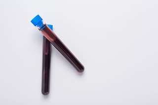 En Rusia se está desarrollando el primer fármaco génico nacional contra la hemofilia B