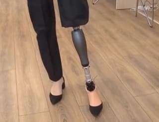 Russian bionic prosthesis "Comet" with domestic hydraulics: from dancing to skiing — without restrictions