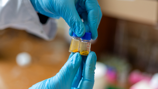 Dozens of times more effective than chemotherapy: UrFU scientists crush cancer with a new drug