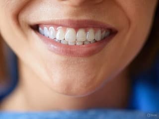 Strengthens enamel and eliminates bacteria: "stop caries" coating developed by scientists in Russia