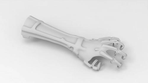 The photo shows the second prototype of the orthosis. For the patient's convenience, the inner part of the palm was left free. The holes are needed for tensioners (the tensioners are fixed on the phalanges of the fingers and then run along the hand, repeating the anatomy of the human hand).
