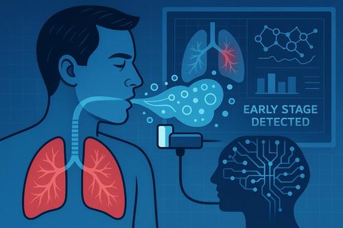 Científicos de Krasnodar crean una prueba de aliento para el diagnóstico temprano del cáncer de pulmón