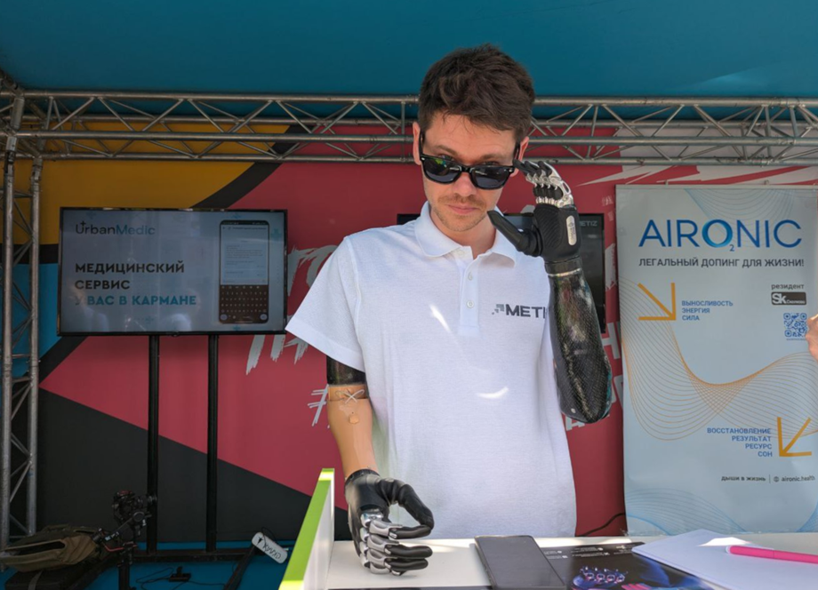 Алексей, пользователь протезов компании «Metiz», представитель компании