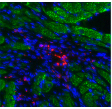 В МГУ разработан новый метод генной терапии для лечения последствий инфаркта миокарда
