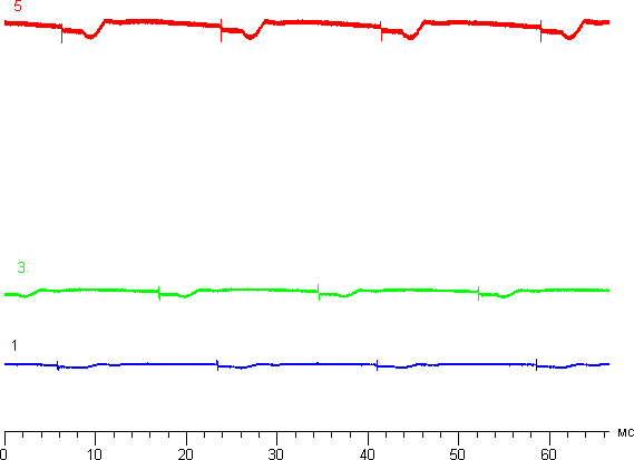 Обзор умных часов Asus ZenWatch 2. Тестирование дисплея