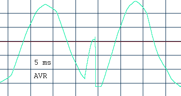 переключение системы avr