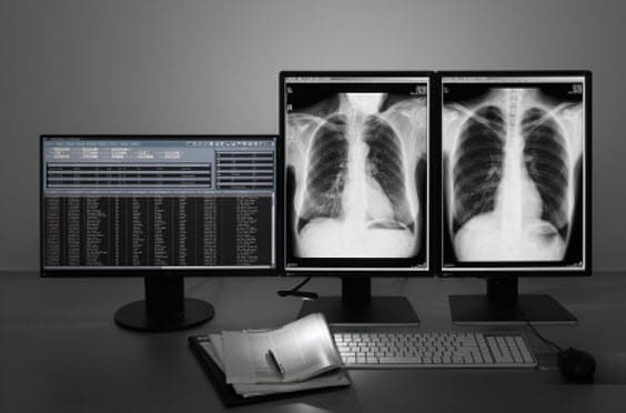 Представлен осветительный аксессуар Eizo RadiLight для медицинских мониторов Eizo RadiForce