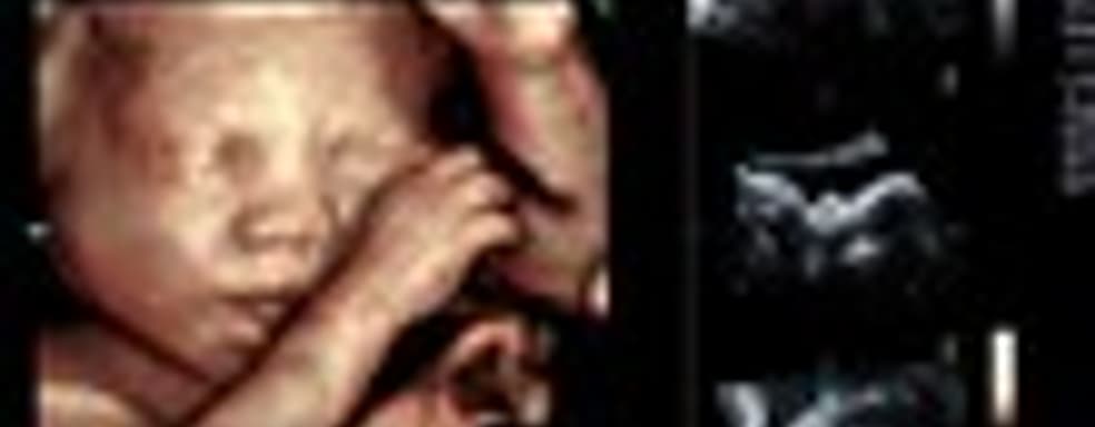 Трехмерное УЗИ от NVIDIA и Siemens Healthcare