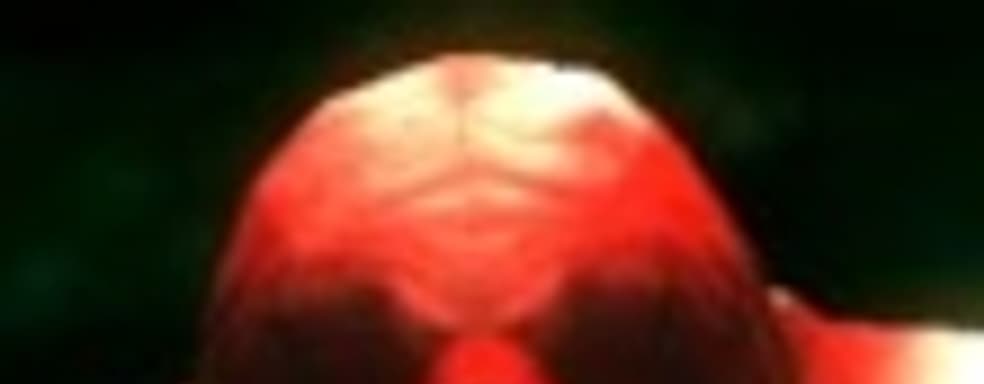 Dementium 2 HD — зачем?!